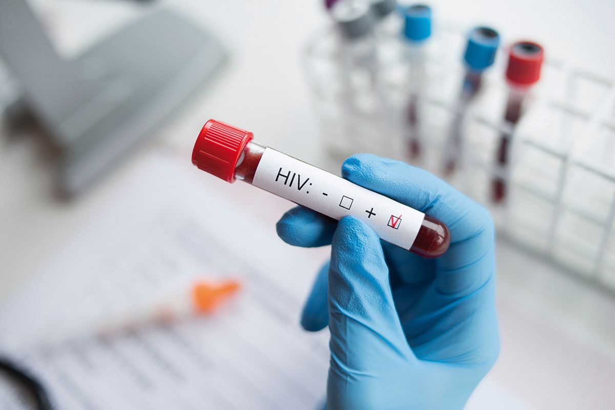 testare-hiv