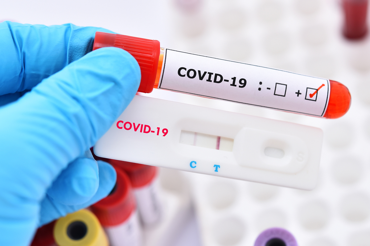 COVID-19