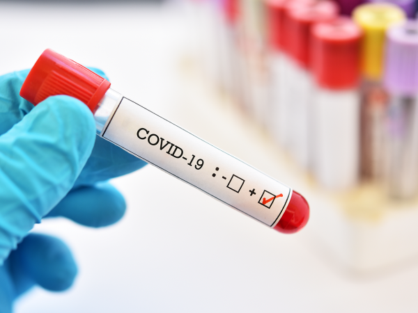 Ccoronavirus-test-600x450