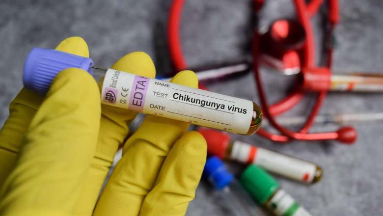 YTEwMmE5OWQxNDdkMTI5Mzg3MzQ2ZmNlN2Y3YzNiZg==.thumb