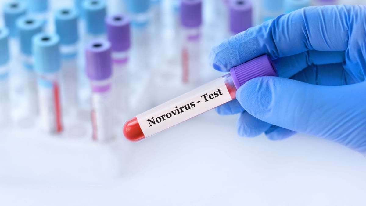 norovirus